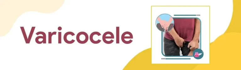Varicocele Treatment in Hyderabad | Surgery & Pain Relief